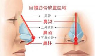 做鼻子要多少钱 做鼻子要多少钱